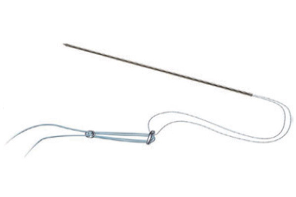 fiber-suture-tape